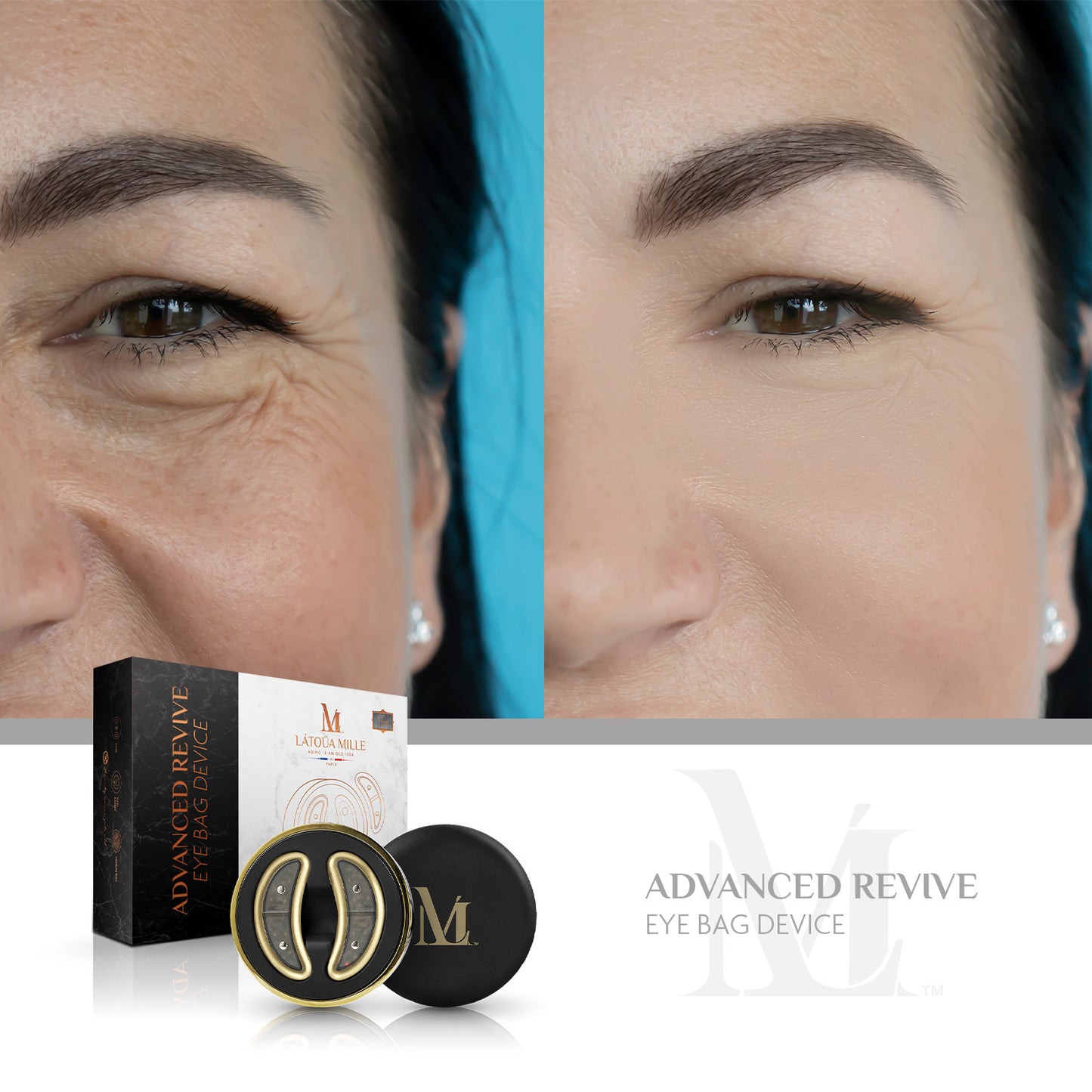 Advanced Revive Eye Bag Device