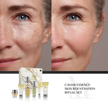 Caviar Essence Skin Rejuvenation Ritual Set