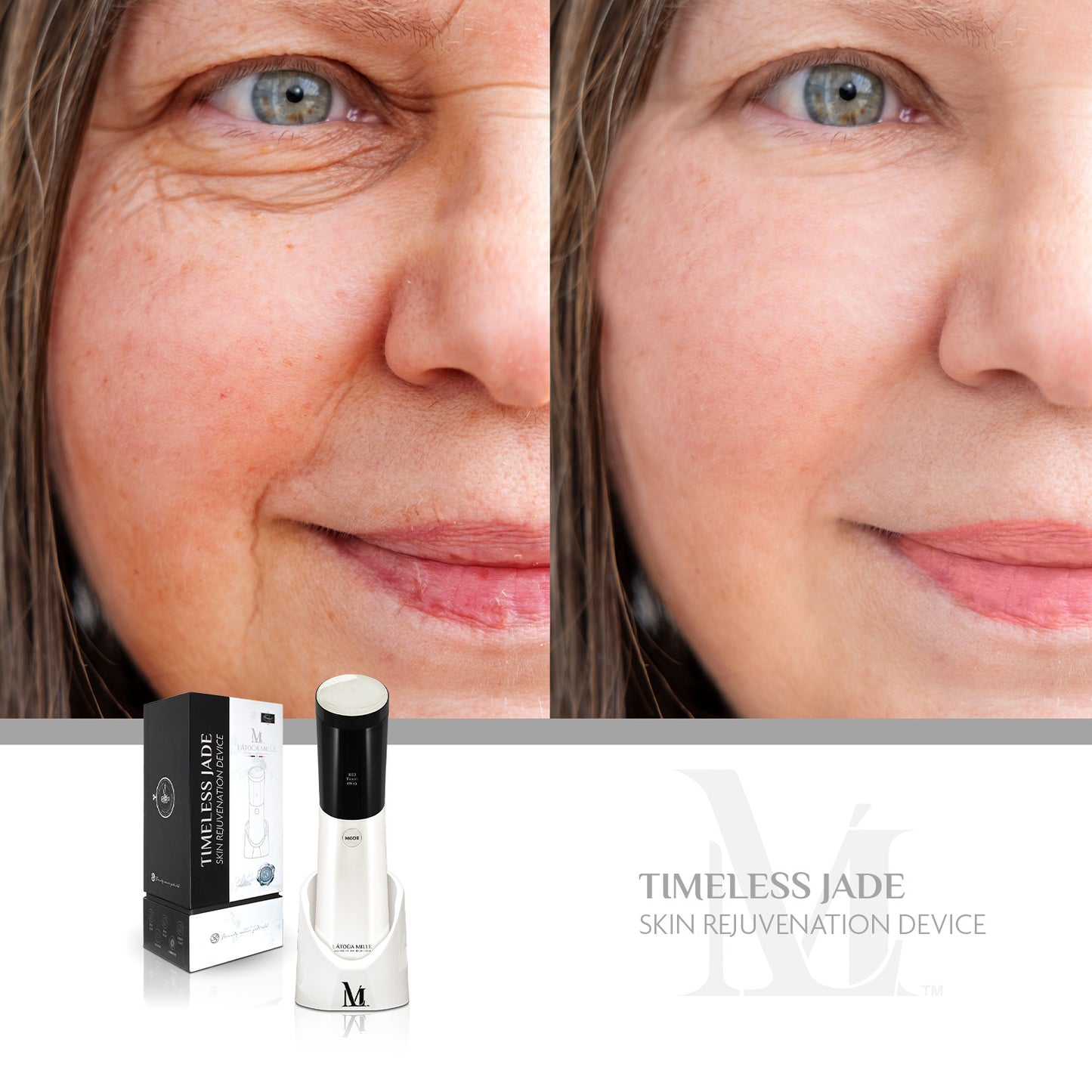 Timeless Jade Skin Rejuvenation Device