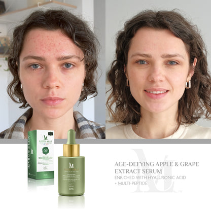 Age-Defying Apple & Grape Extract Serum  Enriched With Hyaluronic Acid + Multi-Peptide