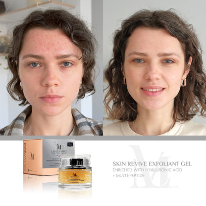 Skin Revive Exfoliant Gel  Enriched With Hyaluronic Acid + Multi-Peptide