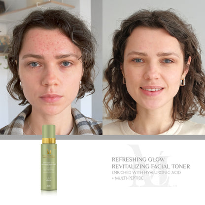 Refreshing Glow Revitalizing Facial Toner  Enriched with Hyaluronic Acid + Multi-Peptide