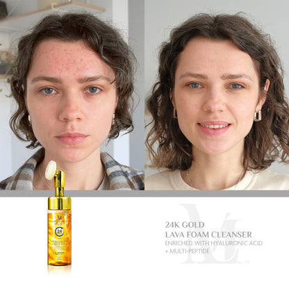 24K Gold Lava Foam Cleaner Hyaluronic Acid + Multi-Peptide (With Brush Head)