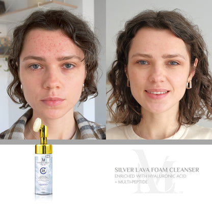 Silver Lava Foam Cleanser Hyaluronic Acid + Multi-Peptide (With Brush Head)