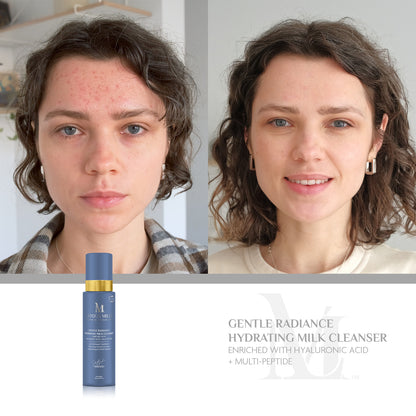 Gentle Radiance Hydrating Milk Cleanser  Enriched with Hyaluronic Acid + Multi-Peptide