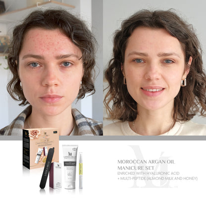 Moroccan Argan Oil Manicure Set Enriched with Hyaluronic Acid and Multi-Peptide (Almond Milk and Honey)